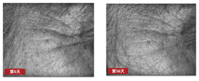 抗衰老护肤品—临床功效测试