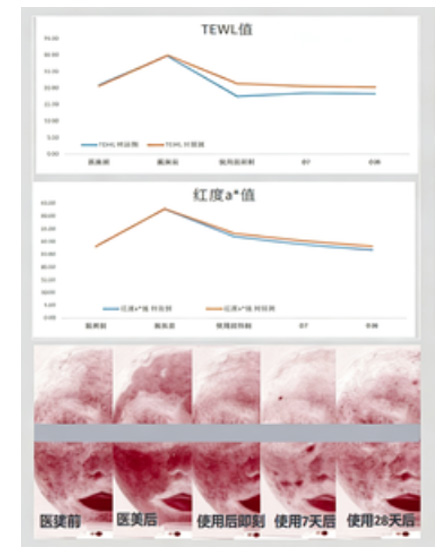 医美术后急护护肤品—即刻舒缓功效评价方案