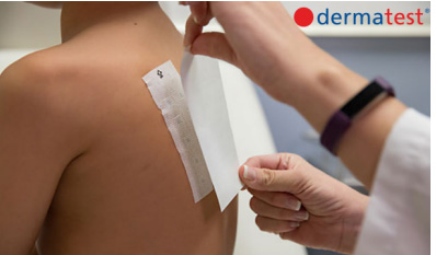 Dermatest认证斑贴试验