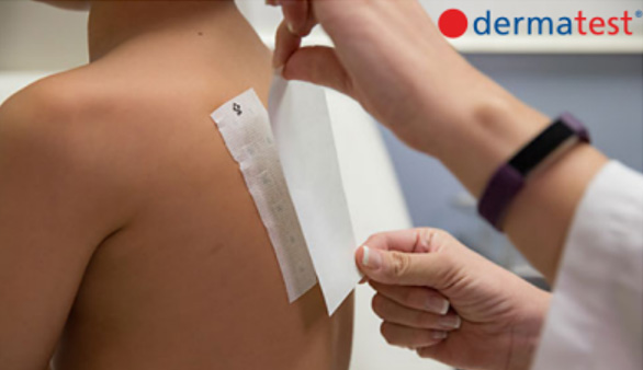 如何利用 Dermatest 给洗洁精品类的差异化定位