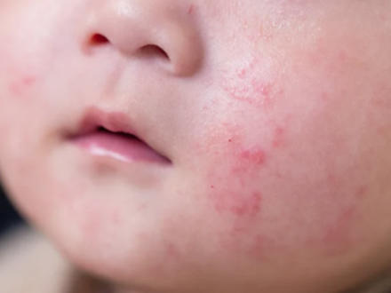 告别口水巾“白牌混战”：Dermatest认证，如何打造母婴赛道的“硬通货”