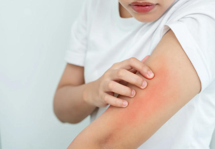 秋冬床品需求升温，ALLERGY UK防过敏友好奖（Allergy Friendly Product Award）如何让被子的“低致敏”更有依据？