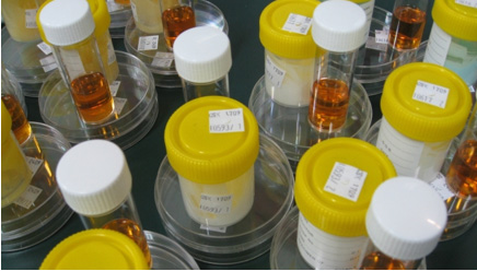 化妆品（护肤品）防腐效能测试（Preservative Efficacy Test）