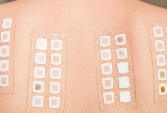 Dermatest皮肤友好认证（Skin-friendly Seal）与斑贴测试（Patch test）